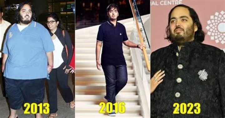 Anant Ambani's Medical Condition: A Comprehensive Insight into His Health Journey