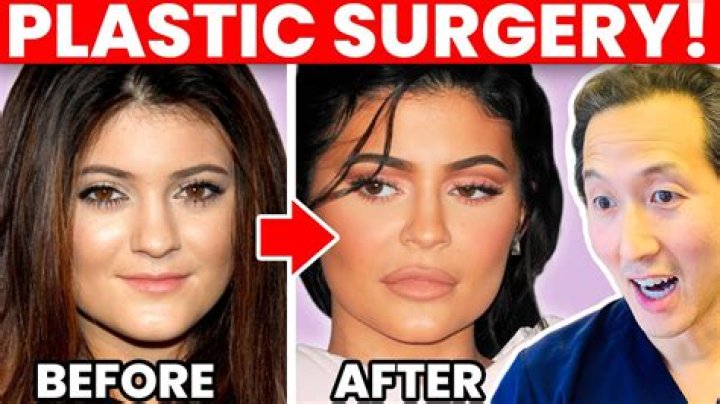 At What Age Did Kylie Get Surgery? Unpacking the Public Timeline