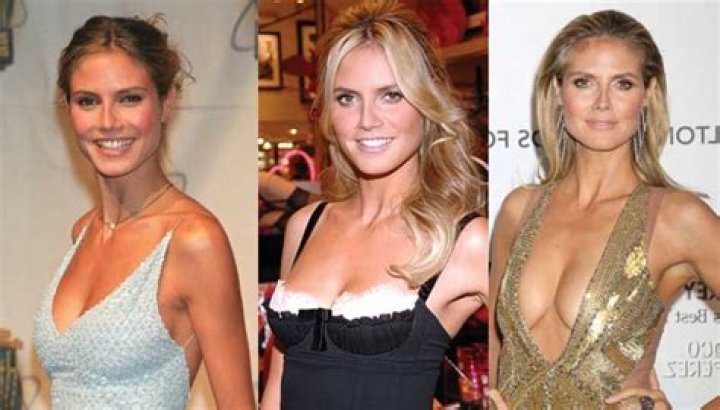 Did Heidi Klum Get a Boob Job in 2024?