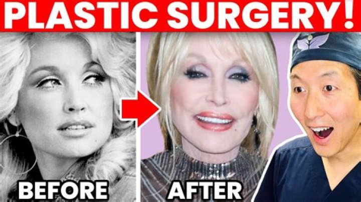 Did Monica Get Plastic Surgery? Unpacking the Buzz Around Famous Faces