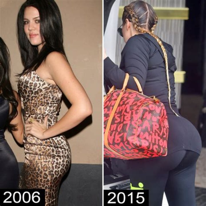 Do the Kardashians Have Butt Implants? Unpacking the Persistent Rumors