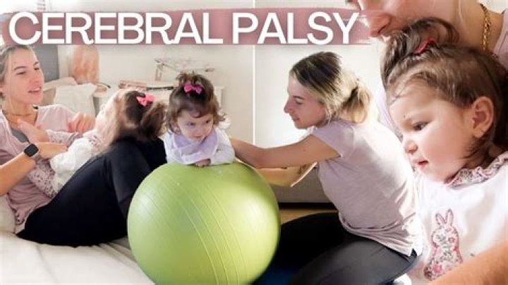 Does Katie Holmes Have Cerebral Palsy? Addressing Public Questions and Facts