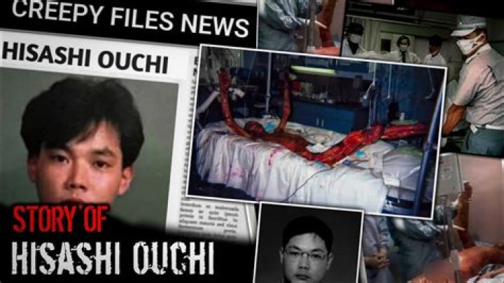 Hisashi Ouchi: The Real Story of a Nuclear Accident Victim