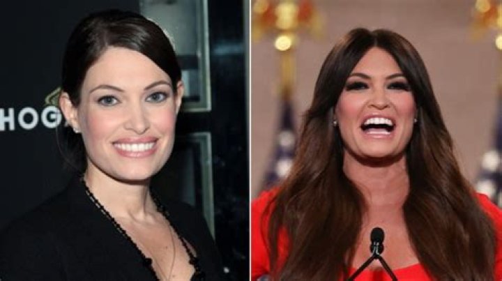 Kimberly Guilfoyle Before and After Plastic Surgery: A Comprehensive Look