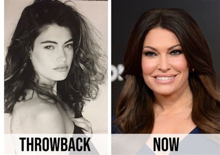 Kimberly Guilfoyle Before and After: A Comprehensive Look at Her Transformation