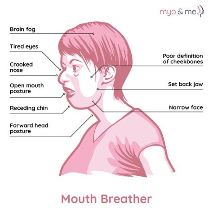 What is Open Mouth Breathing at the End of Life? A Gentle Guide to Understanding and Comfort
