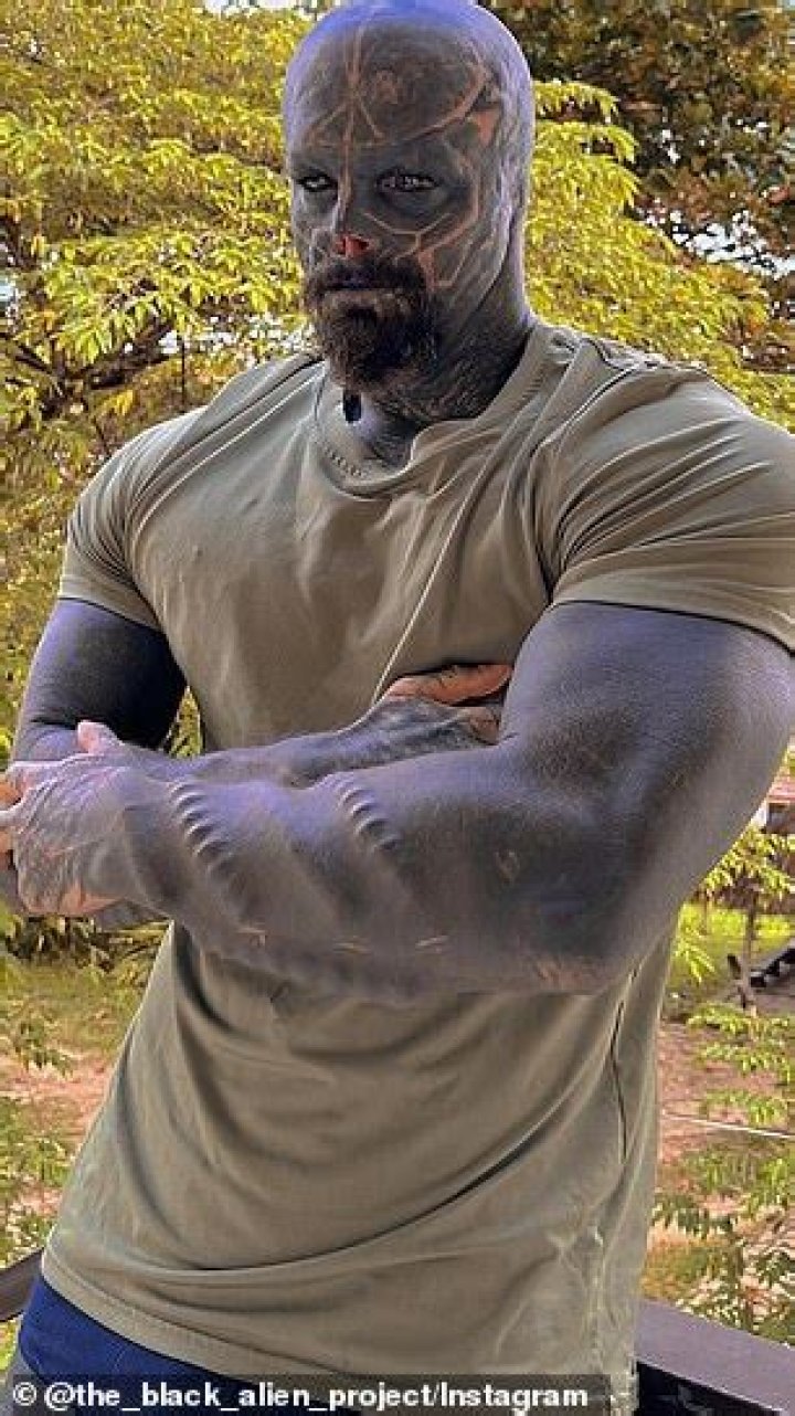 Who is the Black Alien Guy? Exploring the Man Behind the Transformation and Hypothetical Health Considerations