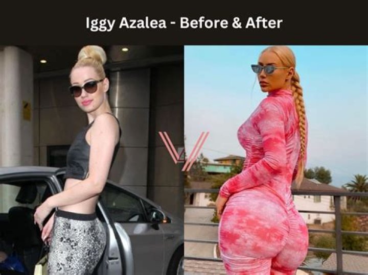 Why Did Iggy Azalea Step Away From Music? Unpacking Her Big Decision